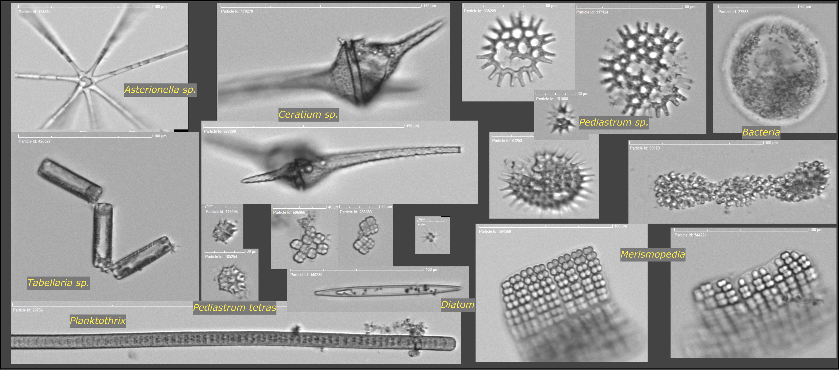 Plankton in watermonster (beeld: CytoBuoy) 